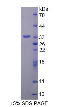 炭疽热毒素受体2(ANTXR2)重组蛋白