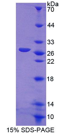 坍塌应答调停蛋白1(CRMP1)重组蛋白