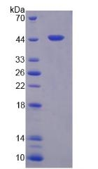 羧肽酶A4(CPA4)重组蛋白