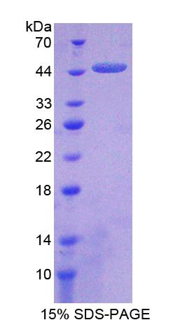 羧肽酶A2(CPA2)重组蛋白