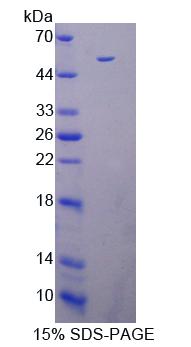 死亡关联蛋白激酶3(DAPK3)重组蛋白