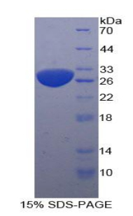 死骨片1(SQSTM1)重组蛋白