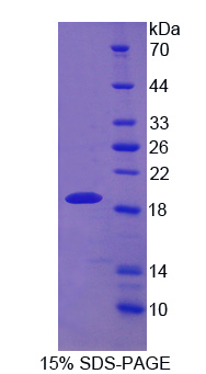 丝织蛋白1(DBN1)重组蛋白
