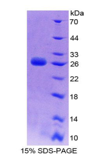 丝裂原激活蛋白激酶激酶激酶1(MAP3K1)重组蛋白