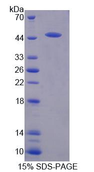 丝裂原激活蛋白激酶13(MAPK13)重组蛋白
