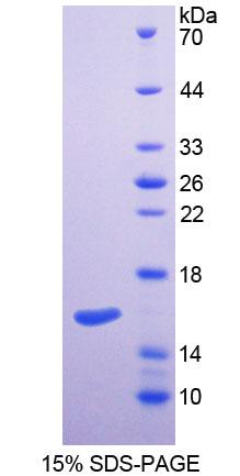 丝氨酸棕榈酰转移酶长链碱性亚基2(SPTLC2)重组蛋白