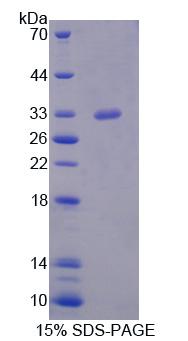 丝氨酸/苏氨酸激酶11(STK11)重组蛋白