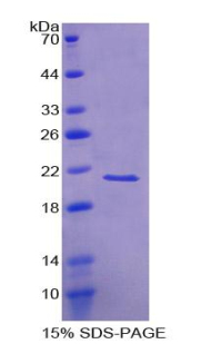 视锥蛋白样蛋白1(VSNL1)重组蛋白