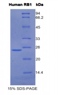 视网膜母细胞瘤蛋白1(RB1)重组蛋白