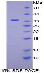 视黄醇结合蛋白3(RBP3)重组蛋白