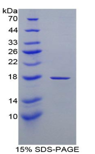 视黄醇结合蛋白1(RBP1)重组蛋白