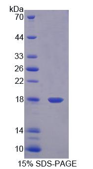 食道癌相关基因4(ECRG4)重组蛋白