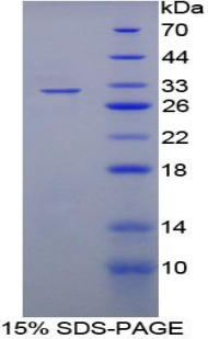 失调蛋白2结合蛋白1(A2BP1)重组蛋白