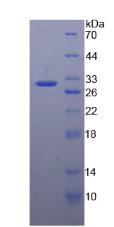 失调蛋白1(ATXN1)重组蛋白
