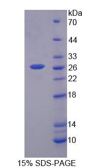 生长因子受体结合蛋白10(Grb10)重组蛋白