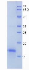 生长分化因子5(GDF5)重组蛋白