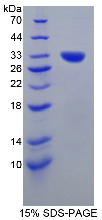 肾小球蛋白(GLMN)重组蛋白