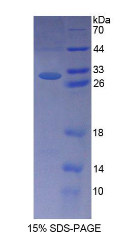 肾结核蛋白2(NPHP2)重组蛋白