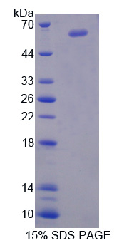 神经细胞黏附分子2(NCAM2)重组蛋白