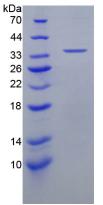 上皮中性粒细胞激活肽78(ENA78)重组蛋白