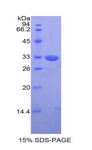 杀伤细胞免疫球蛋白样受体2DS4(KIR2DS4)重组蛋白