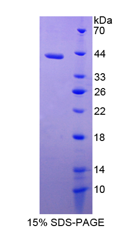 杀伤细胞免疫球蛋白样受体2DL5(KIR2DL5)重组蛋白