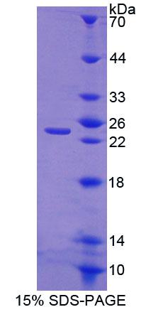 软骨凝集蛋白(CHODL)重组蛋白