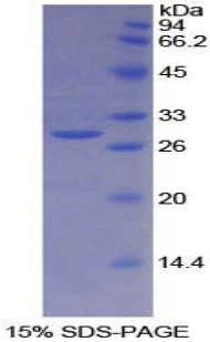 乳腺癌易感蛋白2(BRCA2)重组蛋白