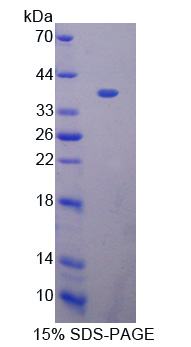 乳腺癌扩增序列3(BCAS3)重组蛋白