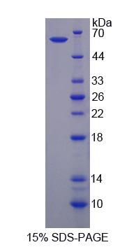 乳腺癌抗雌激素药物耐药性基因3(BCAR3)重组蛋白