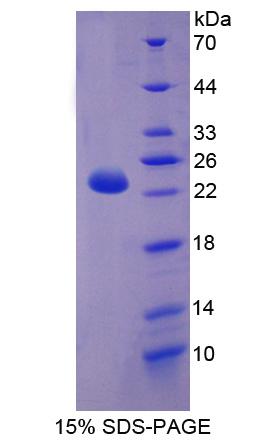 肉毒碱棕榈酰基转移酶1B(CPT1B)重组蛋白