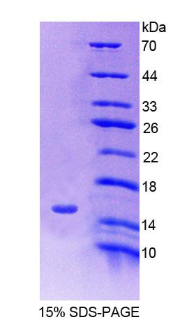 溶质载体家族30成员3(SLC30A3)重组蛋白