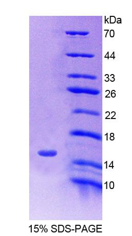 溶质载体家族30成员10(SLC30A10)重组蛋白