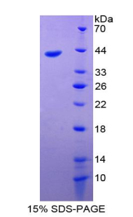 绒毛蛋白1(VIL1)重组蛋白