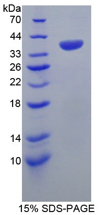 热休克转录因子4(HSF4)重组蛋白
