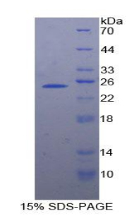 染色体结构维持蛋白3(SMC3)重组蛋白