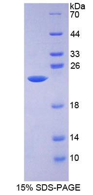 醛脱氢酶9家族成员A1(ALDH9A1)重组蛋白