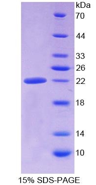 醛脱氢酶1家族成员A3(ALDH1A3)重组蛋白