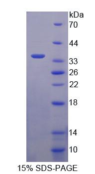 去唾液酸糖蛋白受体2(ASGR2)重组蛋白