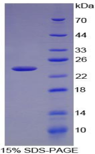 趋化因子C-X-C-基元配体15(CXCL15)重组蛋白