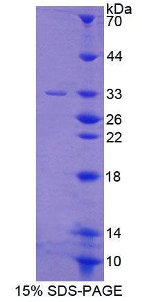 前列腺素F2受体负调节因子(PTGFRN)重组蛋白