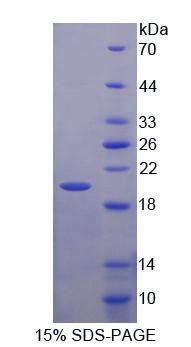 前列腺素E受体1(EP1)重组蛋白