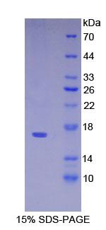 前-B-淋巴细胞基因1(VPREB1)重组蛋白
