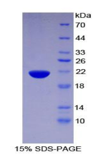 葡萄糖转运蛋白4(GLUT4)重组蛋白