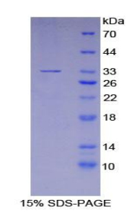 嘌呤能受体P2Y14(P2RY14)重组蛋白