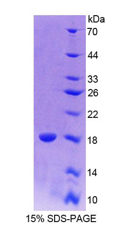 配对框基因6(PAX6)重组蛋白