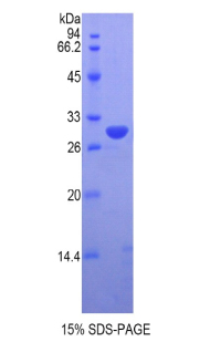 牛痘相关激酶1(VRK1)重组蛋白
