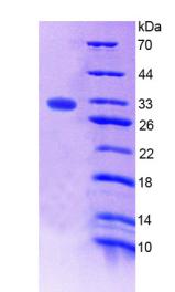 凝血因子ⅩⅢA1肽(F13A1)重组蛋白