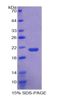 凝血因子Ⅱ(F2)重组蛋白
