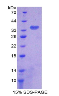 柠檬酸合酶(CS)重组蛋白